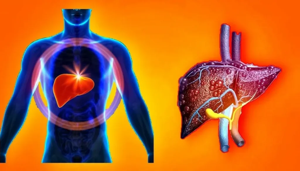 लिवर ट्यूमर से लड़ रहीं दीपिका कक्कड़