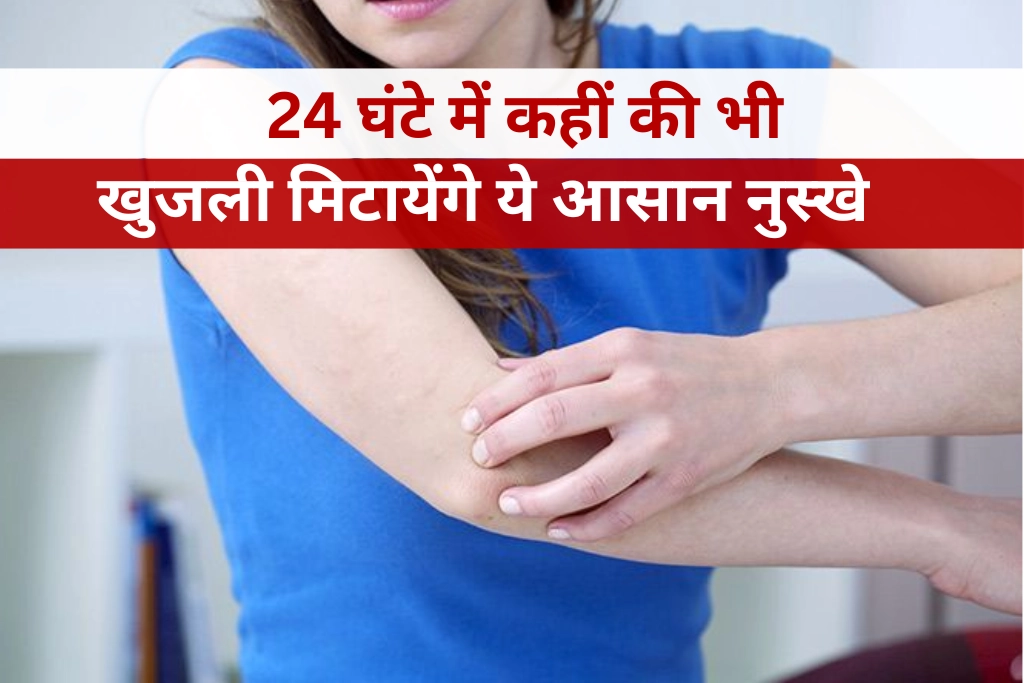 24 घंटे में खुजली से छुटकारा पाने के आसान उपाय, कहीं की भी खुजली मिटाये